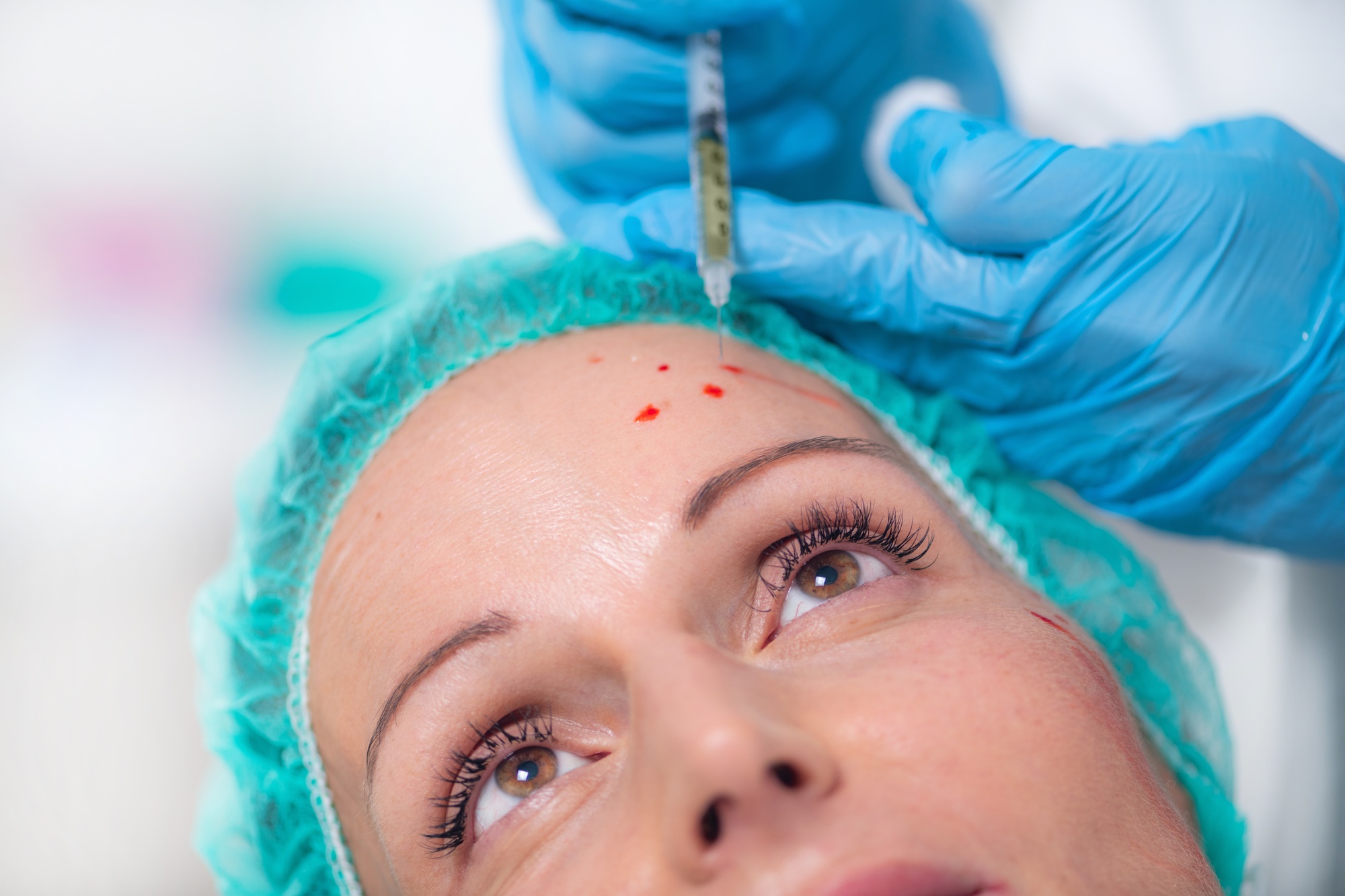 Botox and Its Role in Chronic Pain Management: An In-Depth Analysis